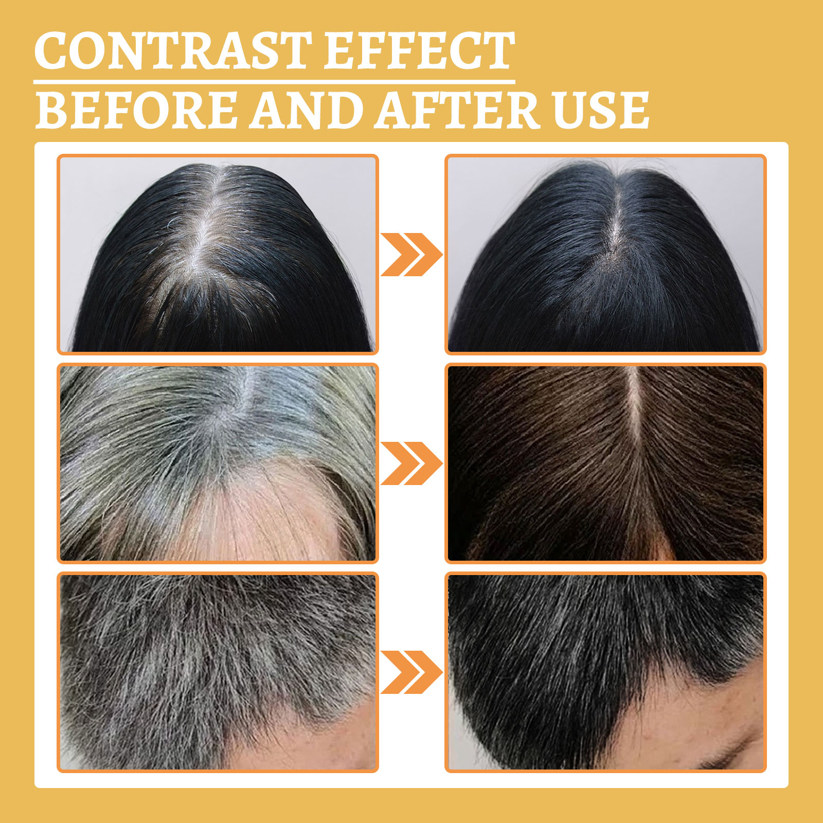 سائل الشعر الأسود غانوديرما لو - مراجعة Root Stimulator Liquid وسعره